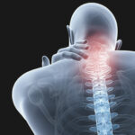 頚椎ヘルニアの治療方法とストレッチ方法【わかりやすい動画解説付き】